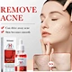 serums